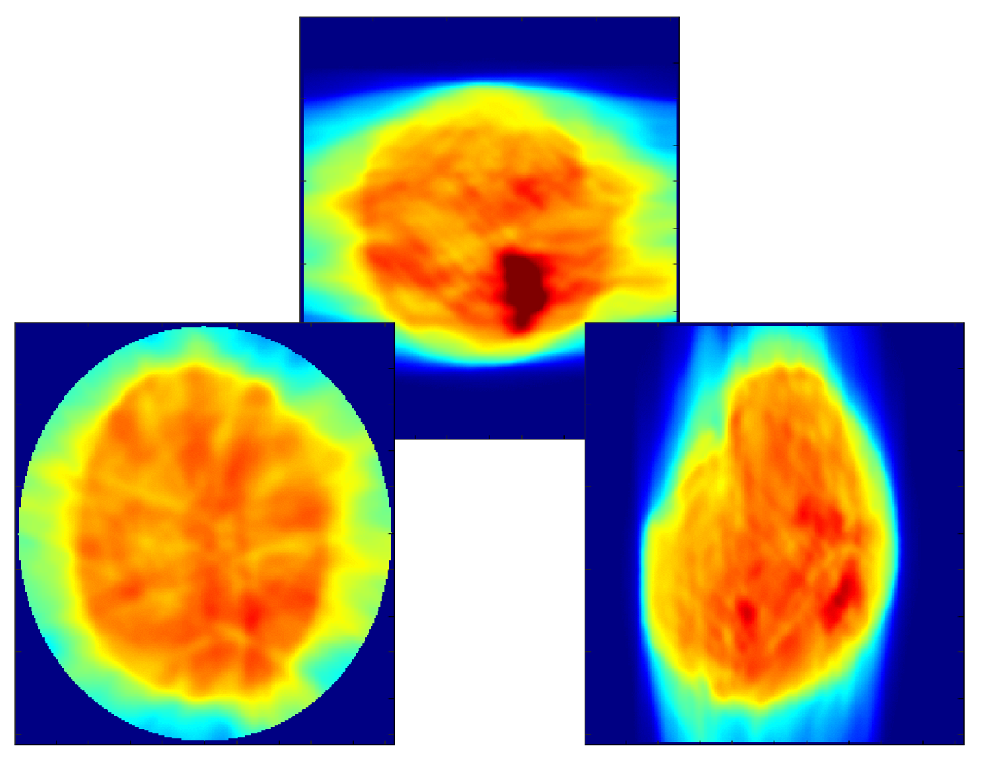 Dosimetry and Beam Monitoring