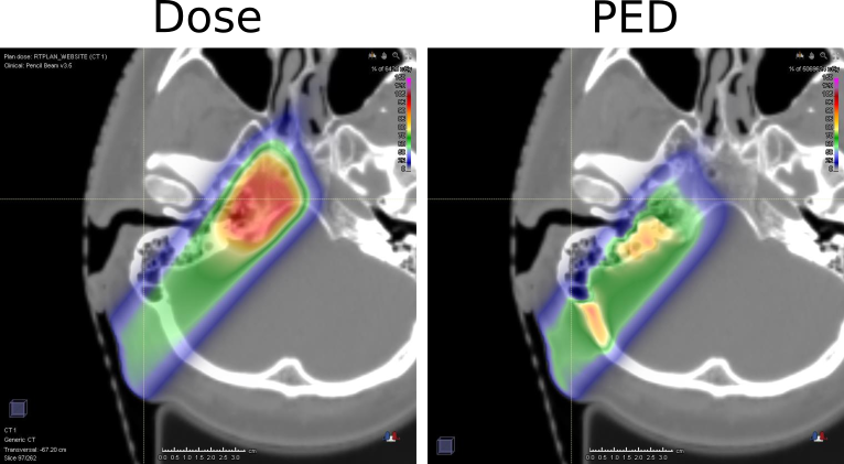 FIGURE1_FilteringPET_DOSE_PED